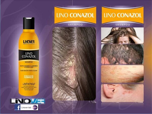 Lino Conazol Shampoo