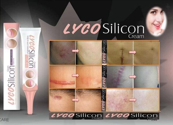 Lyco Silicon Cream